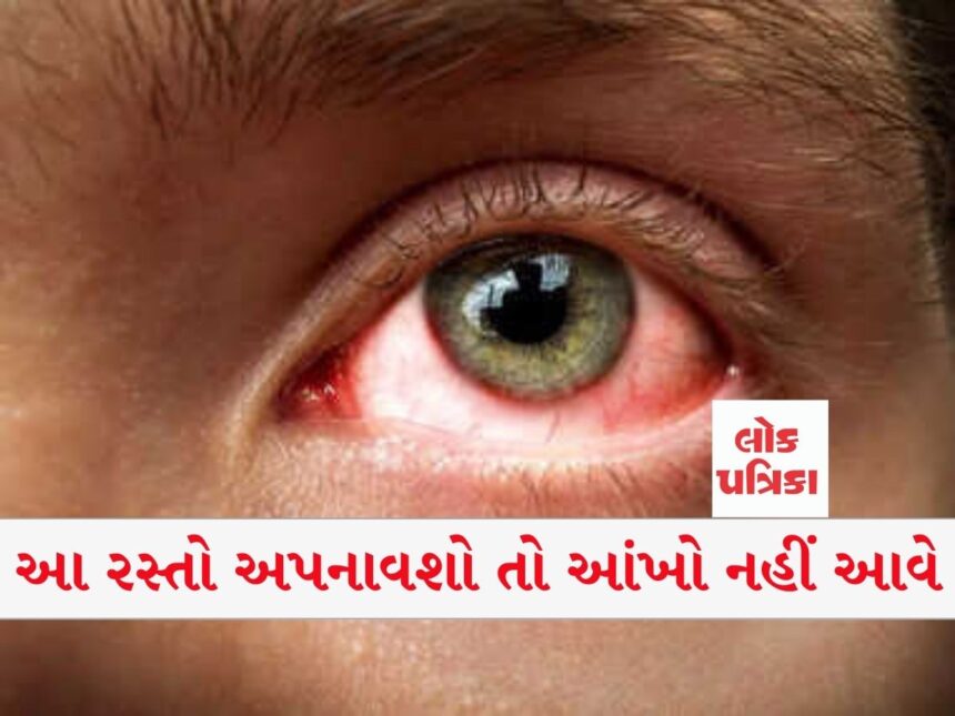 આ રસ્તો અપનાવશો તો આંખો નહીં આવે