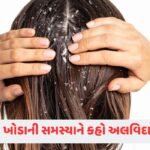 Health Tips: દાંતની પીળાશ કેવી રીતે દૂર કરવી? જાણો ઘરગથ્થુ ઉપાય 3 - Lok Patrika Beauty Tips: થોડાક જ દિવસમાં દૂર થશે ખોડાની સમસ્યા, કરો આ અસરકારક ઉપાય