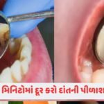 Beauty Tips: થોડાક જ દિવસમાં દૂર થશે ખોડાની સમસ્યા, કરો આ અસરકારક ઉપાય 3 - Lok Patrika દાંતની પીળાશ કેવી રીતે દૂર કરવી? જાણો ઘરગથ્થુ ઉપાય