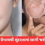 ઘરમાં પડેલી આ વસ્તુ છે ખાસ, ચહેરા પર ડાઘ-ધબ્બા થશે ગાયબ